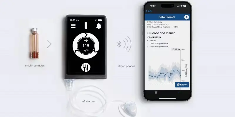 Pompa iLet Bionic Pancreas si un telefon mobil cu aplicația de pompa